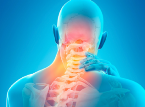 Comprendre la cervicalgie et comment la soulager